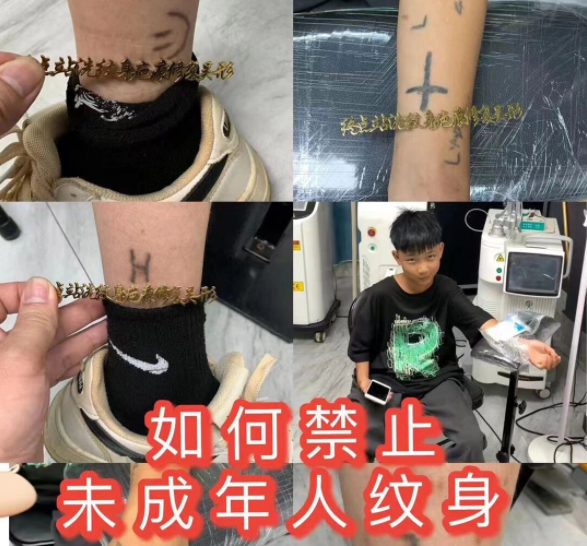 >挽回了丢失掌管了公道也给文身服务供给者敲响了法令警钟